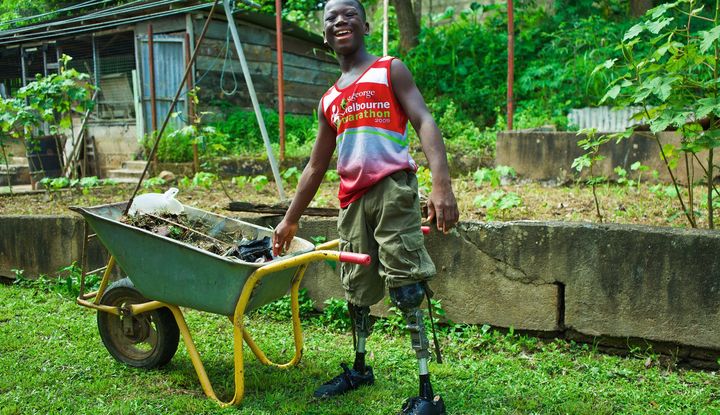 Ein junger Mann mit Bein-Prothesen steht im Garten und lacht